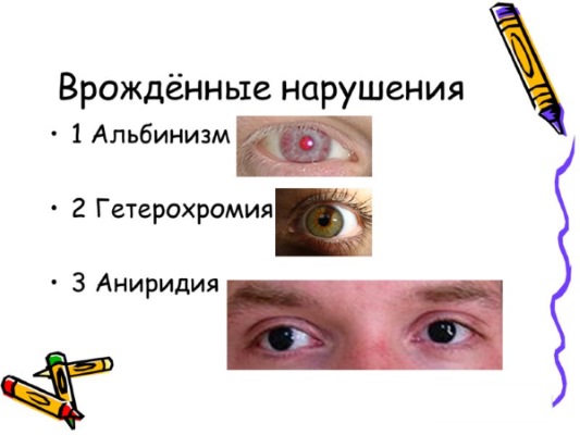 Цвет глаз у новорожденных. Когда меняется, формируется окончательно, возраст, какой бывает