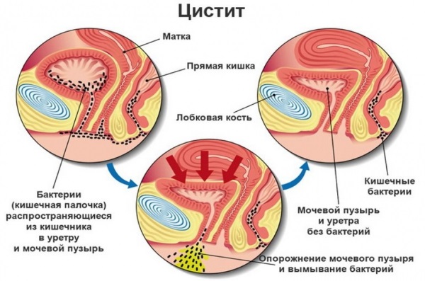Тянет живот на ранних сроках беременности, как при месячных, до задержки, ноет в пояснице, с выделениями и без. Что делать?