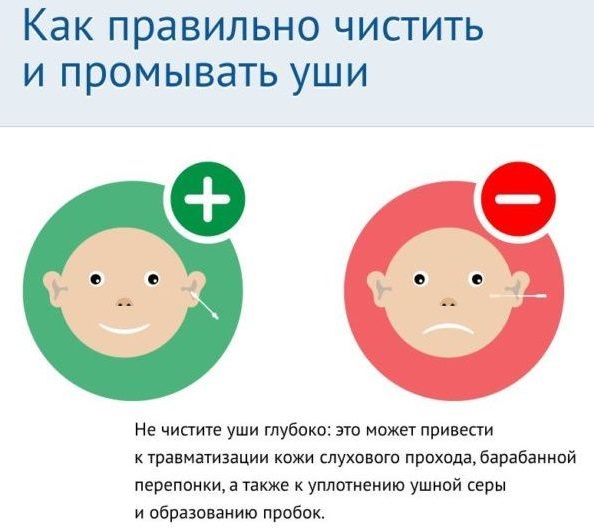 Уход за новорожденным в первый месяц, в первые дни жизни ребенка. Как ухаживать за кожей, пупком, слизистыми