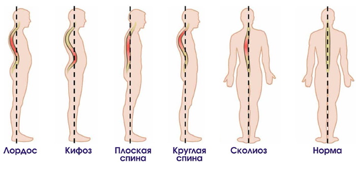 Упражнения для роста тела в высоту для подростков, детей. Как выполнять