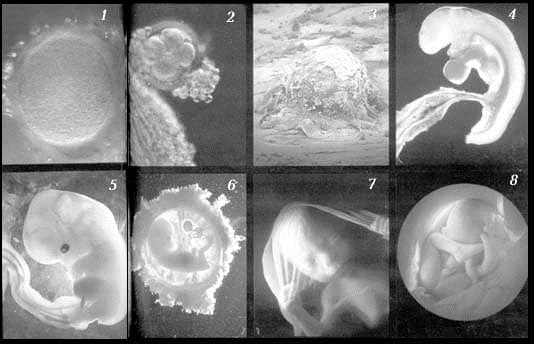 УЗИ для определения беременности на ранних сроках: как делается, что показывает, погрешность определения пола, когда делать