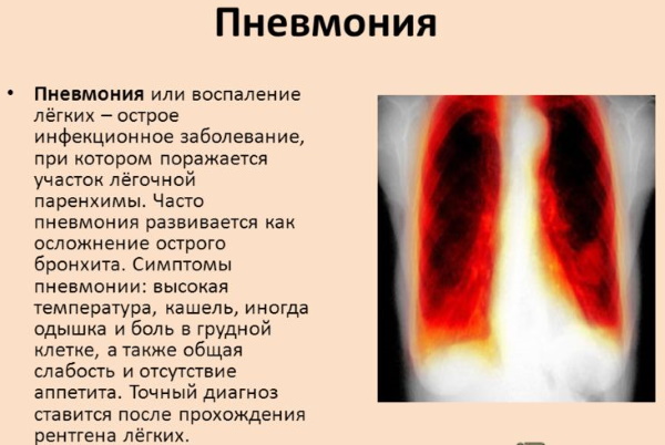 Везикулопустулез у новорожденных детей. Что это такое, причины, лечение, клинические рекомендации