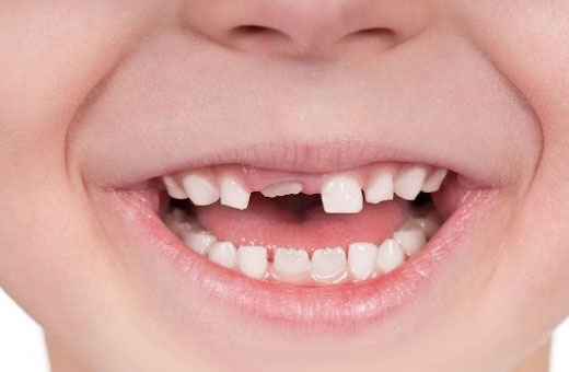 Свечи Вибуркол для детей при прорезывании зубов, температуре, ОРВИ. Инструкция, цена, отзывы