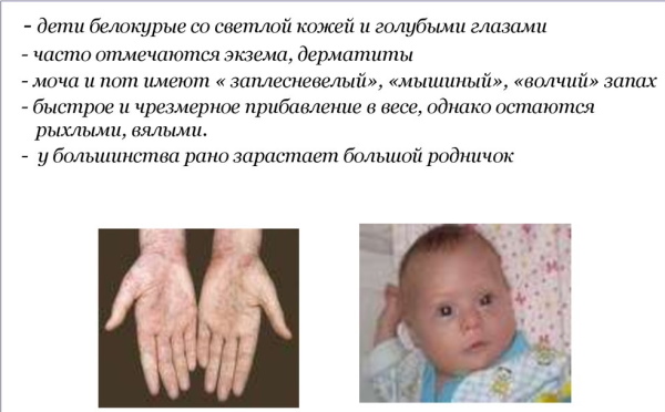 Витамины для роста ребенка 12-13-14 лет. Рейтинг лучших