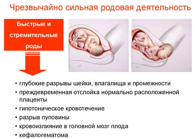 Вторые роды. Как проходят, отзывы рожавших мамочек, сколько длятся, как начинаются, особенности