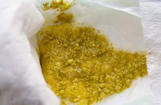 Зеленый стул у грудничка на грудном, искусственном, смешанном вскармливании. Причины и лечение