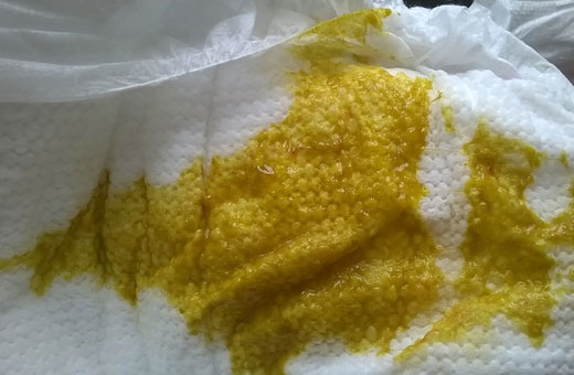 Зеленый стул у грудничка на грудном, искусственном, смешанном вскармливании. Причины и лечение