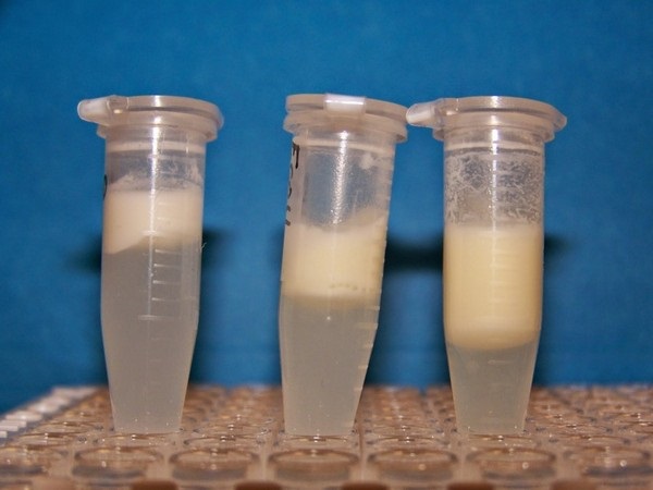 Как повысить жирность грудного молока кормящей маме, как проверить