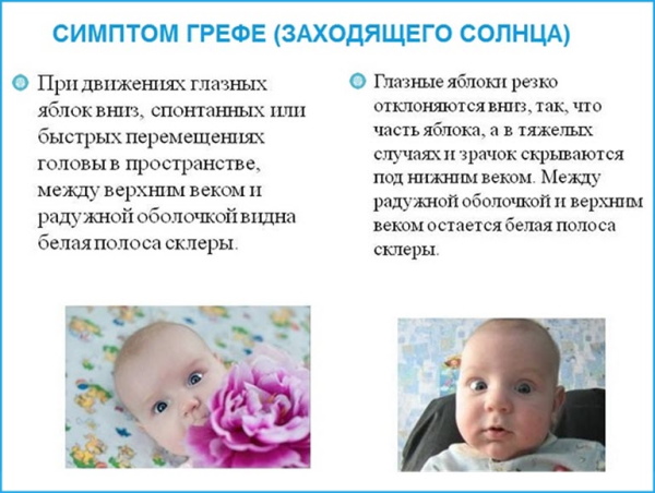 Зрение у новорожденных по месяцам, в первые дни. Таблица, описание, норма