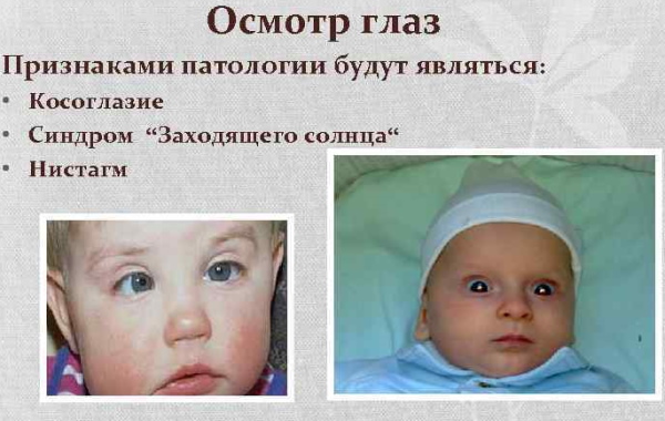 Зрение у новорожденных по месяцам, в первые дни. Таблица, описание, норма